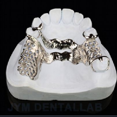 Vitalin Denture Framework